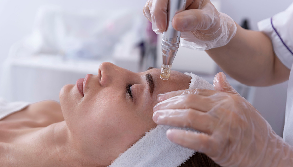 microneedling-traitement